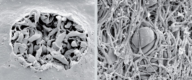 Imagens de microscópio