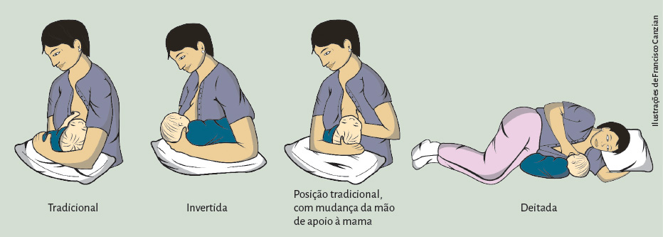 Desenho mostrando quatro posições de amamentação: Tradicional; Invertida; Posição tradicional, com mudança da mão de apoio à mama; Deitada