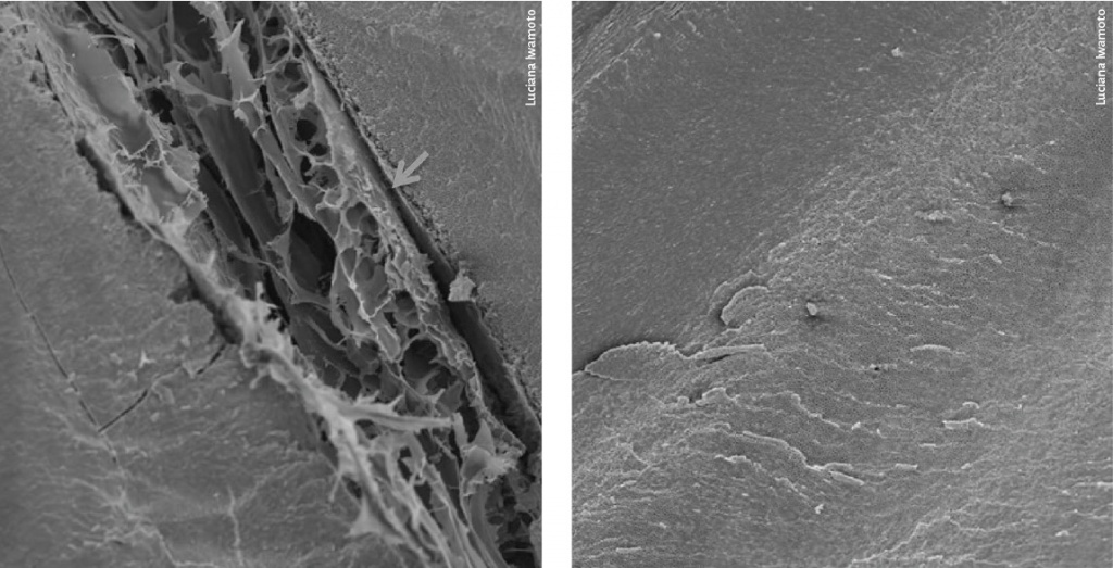 Duas imagens microscopia eletrônica de varredura