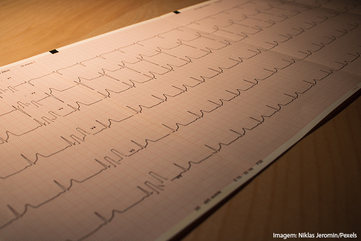Exame de eletrocardiograma