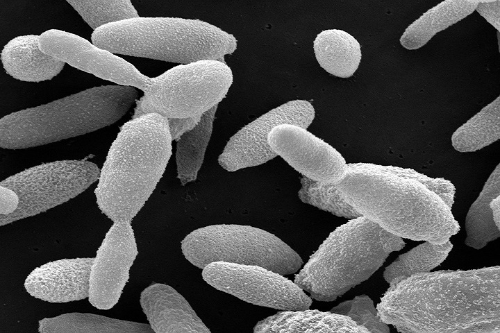 Leveduras do fungo Sporothrix brasiliensis, o principal agente de esporotricose felina no Brasil. Microscopia eletrônica de varredura. Aumento, 27.000 X