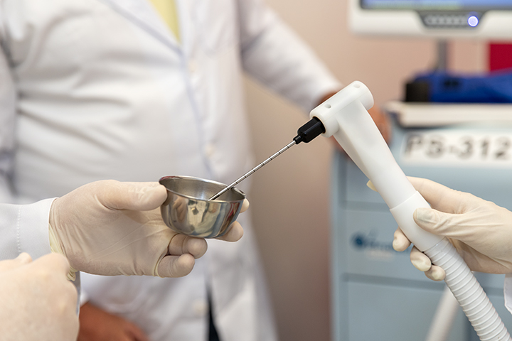 A imagem mostra um procedimento médico, aparentemente relacionado a crioterapia ou crioablação. Há um dispositivo cilíndrico branco sendo segurado por uma mão enluvada, conectado a uma haste metálica fina que está sendo direcionada para um recipiente metálico pequeno, semelhante a um pote. Em segundo plano, pessoas em jalecos brancos estão presentes, indicando um ambiente clínico ou hospitalar. Ao fundo, há equipamentos médicos, como um monitor, que parece estar ligado ao procedimento.