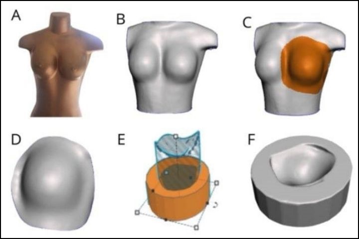 Processo de produção do molde de uma prótese personalizada externa de mama